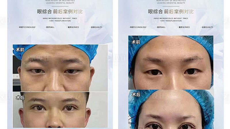 昆明激光祛斑，如何选择性价比高的机构？**