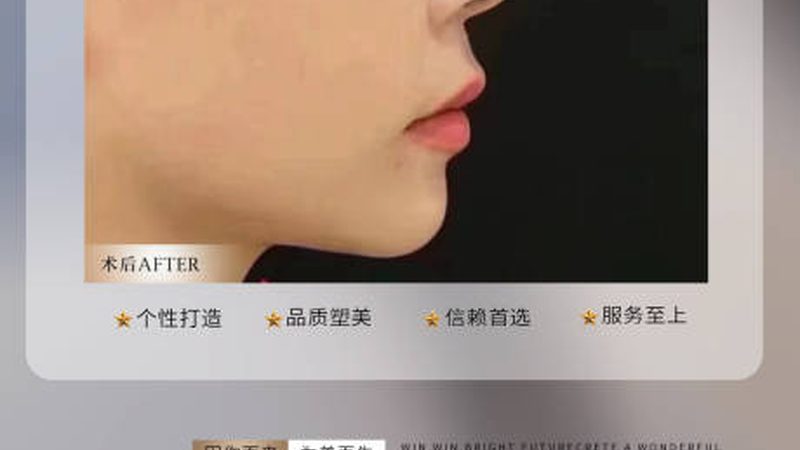 韩式隆鼻失败修复：揭秘价格背后的关键因素