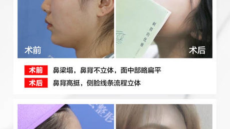 食品级玻尿酸：揭秘其品牌口碑背后的秘密