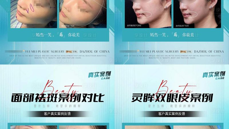 医美面膜与普通面膜：揭秘两者差异，选择更明智