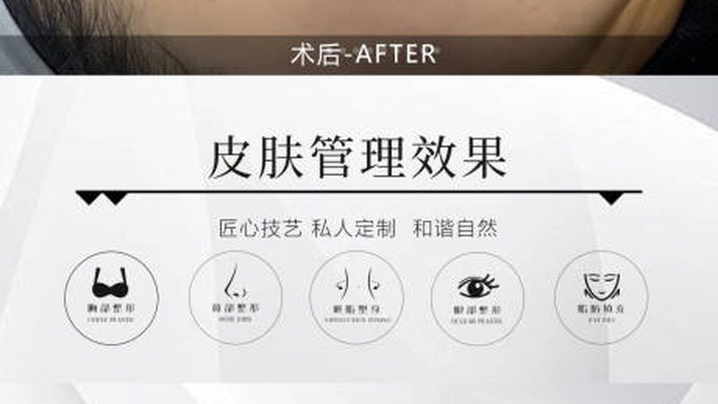 激光祛斑美容院专用机器：揭秘其核心技术与应用场景