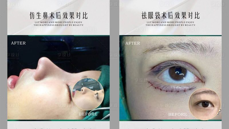 揭秘皮肤管理项目价格背后的秘密