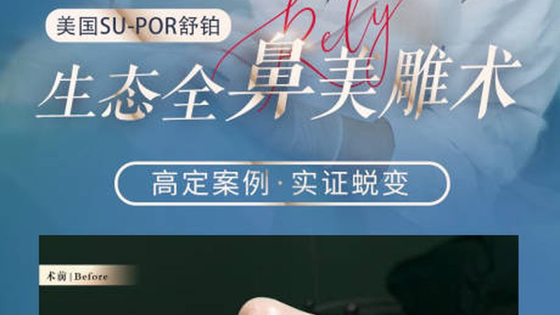 在选购设备时，除了价格，还需要关注设备的性能和适用性。以下是一些选购要点：