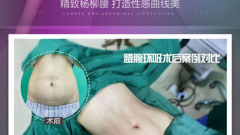 食品级玻尿酸：揭秘广州市场的秘密