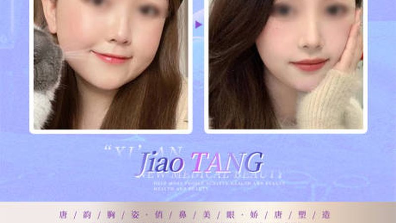 玻尿酸隆鼻：价格之外，你还需要了解这些**