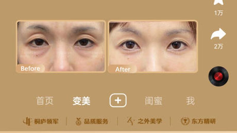 成都轻医美注射注意事项