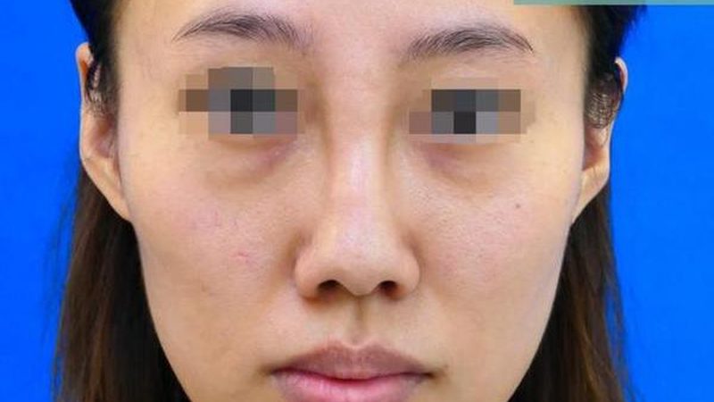 上海激光美容医院资质查询：揭秘合规之路